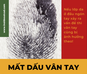 Tình trạng mất dấu vân tay