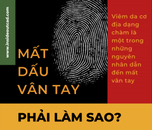 Khắc phục tình trạng mất dấu vân tay
