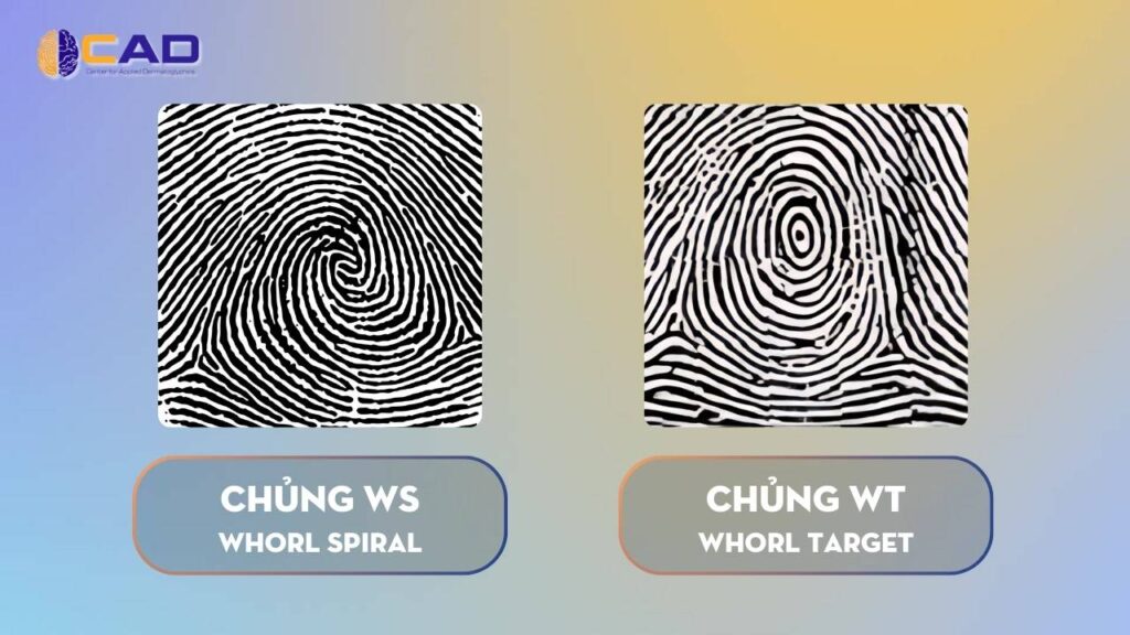 Chủng WS & chủng WT - Whorl Spiral - Whorl Target