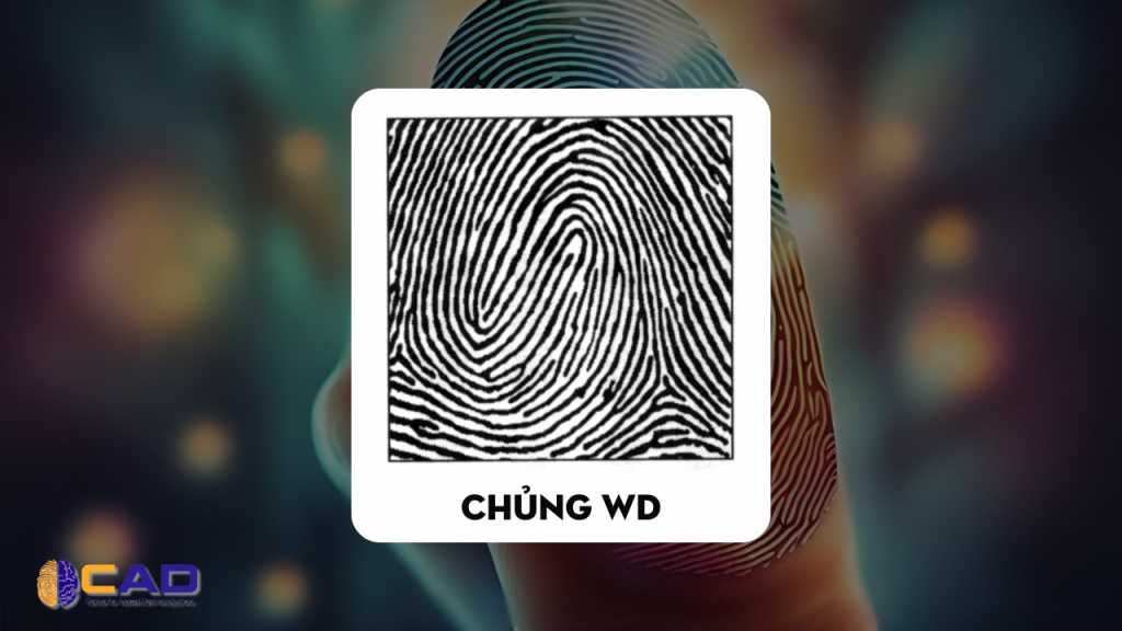 Đặt điểm của người có chủng vân tay Wd