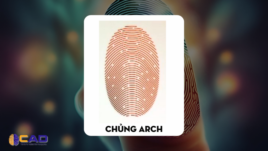 Đặc điểm của người có vân tay chủng núi Arch