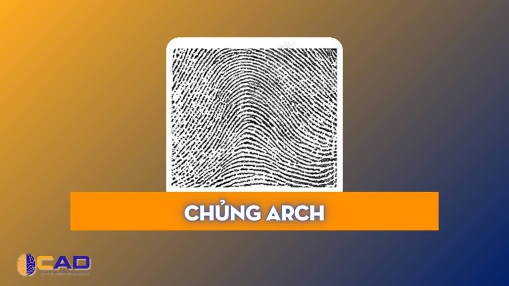 Sinh trắc vân tay là gì - Chủng Arch